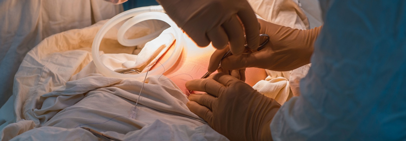 Qualität und Vertrauen vereint in der Magenverkleinerung Türkei Beste klinik