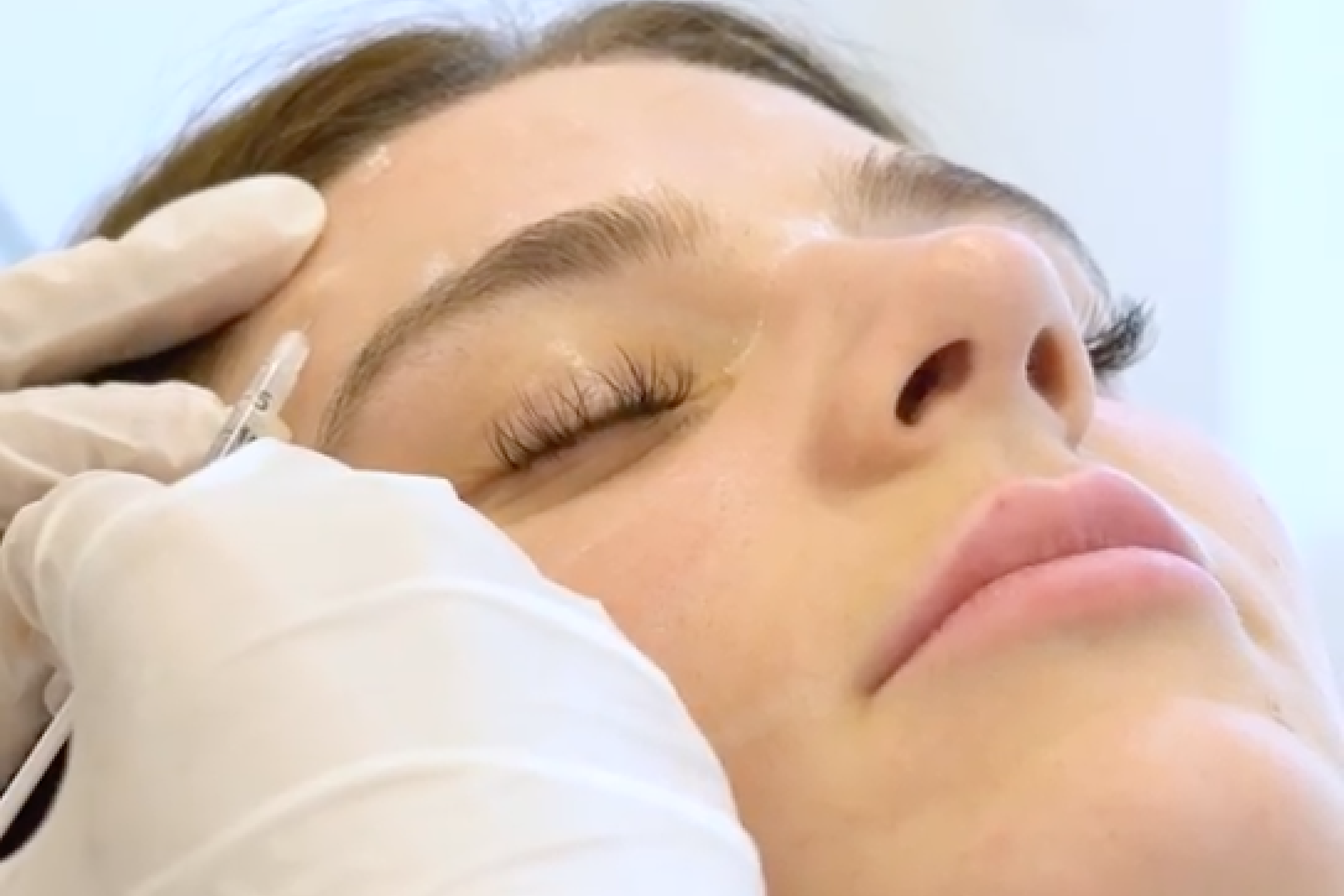 MY AESTHETICS – Ihr Experte für Lippen Aufspritzen Nürnberg